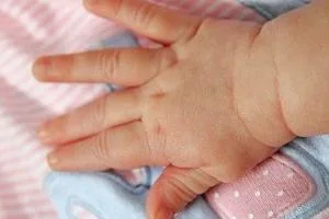 زایمان عجیب