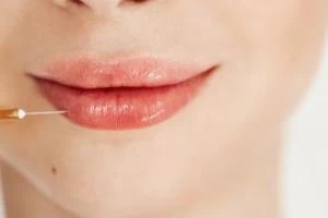 تزریق فیلر لب