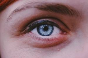 درمان خشکی دور چشم