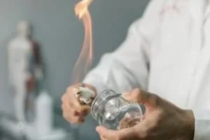 حجامت