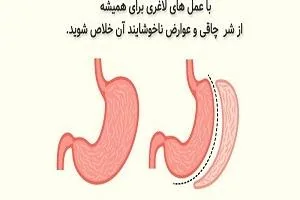 عمل لاغری توسط بهترین جراح در اراک