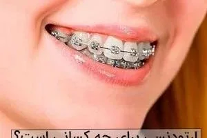 ارتودنسی دندان