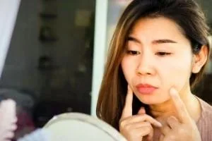 علائم لوپوس