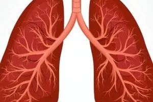آبسه ریه