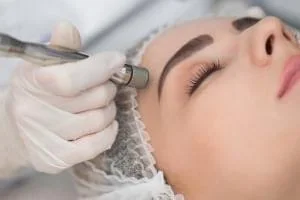 میکرودرم ابریژن