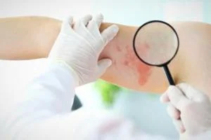 علائم مشکل ریه