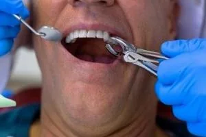 دیابت و دندان