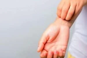 خارش بدن