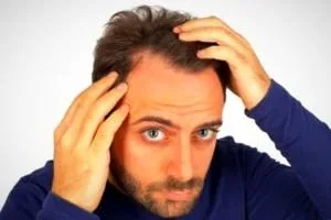 جلوگیری از ریزش مو