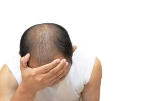 درمان جدید ریزش مو