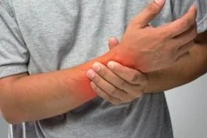 آرتروز