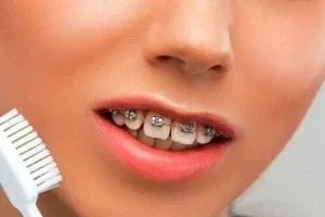 انواع مختلف ارتودنسی
