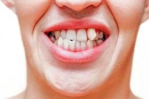 اوربایت