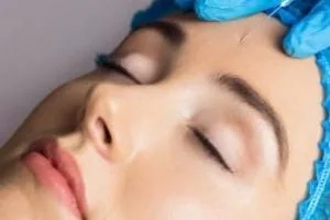 بوتاکس در بارداری