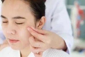 طب سوزنی صورت