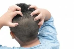 اگزما پوست سر
