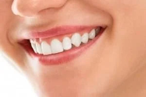 سلامت دهان و دندان