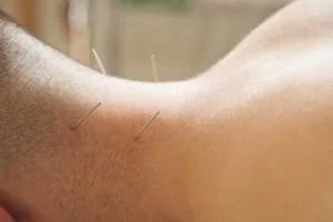 طب سوزنی دیابتی