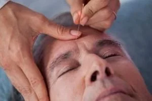 طب سوزنی