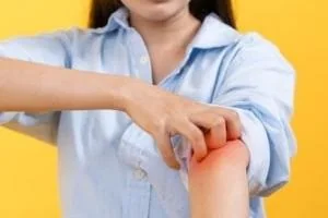 آلرژی های عجیب