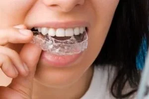 نایت گارد دندان