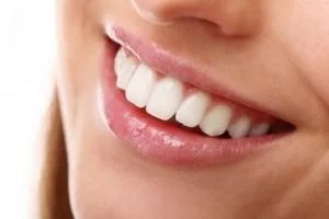 باندینگ دندان