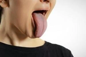 باردار شدن زبان