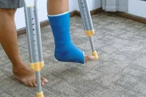 پای گچ گرفته