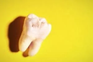 کرم خوردگی دندان