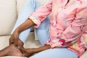 واریس بارداری