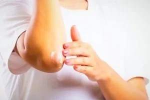 رفع سیاهی آرنج و زانو