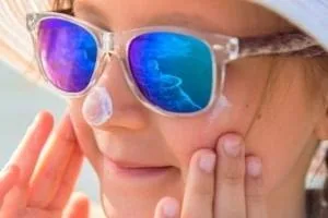 آفتاب سوختگی