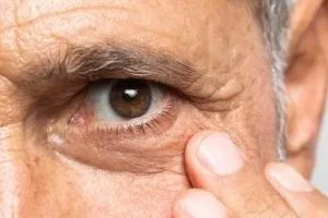 گوارش و بیماری چشم