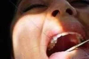 رژیم زجر آور