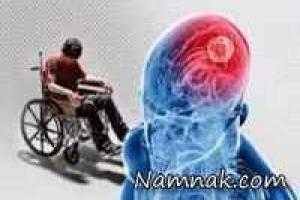 بیماری-ام-اس