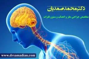 تومور های مغزی