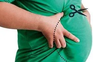 مشکلات چاقی