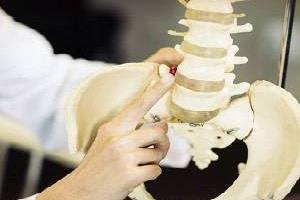 درمان ستون فقرات