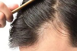 سلامت مو