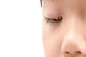 گل مژه
