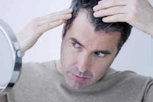 درمان ریزش موی در شقیقه ها