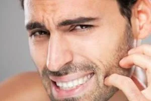 درمان سوزش بعد اصلاح صورت و بدن 