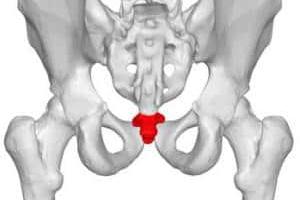 درد دنبالچه