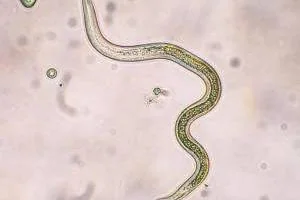 نشانه انگل