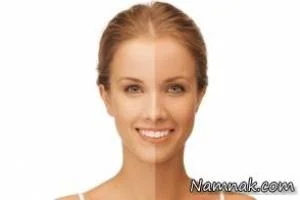 برنزه کردن
