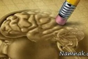 آلزایمر