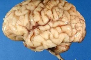 مغز