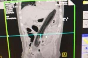 بادمجان 30 سانتی متری