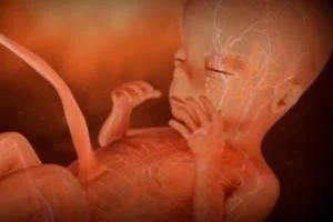 علائم جنین مرده