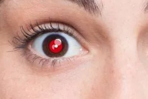 قرمزی چشم در عکس